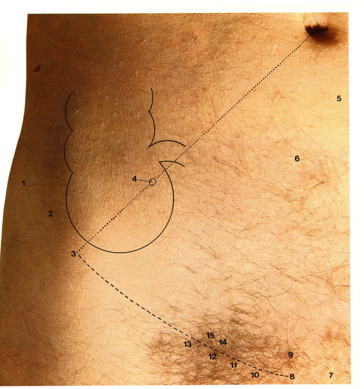 <p>« point de McBurney »</p><p><span>zone de la paroi abdominale inférieure droite → position variable affectée par la posture et distension</span></p>
