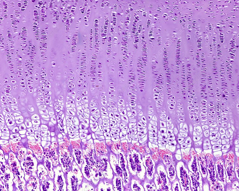 <p>Endochondral ossification</p>