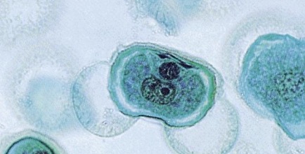 <p>Identify the stage of the pollen grain.</p>