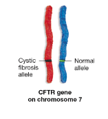 <ul><li><p class="Paragraph SCXW214996520 BCX8" style="text-align: left;"><span style="line-height: 20.925px;">Cystic fibrosis – a genetic disorder that primarily affects the lungs&nbsp;</span></p></li></ul><ul><li><p class="Paragraph SCXW214996520 BCX8" style="text-align: left;"><span style="line-height: 20.925px;">Originates in one gene and has two alleles&nbsp;</span></p></li></ul><ul><li><p class="Paragraph SCXW214996520 BCX8" style="text-align: left;"><span style="line-height: 20.925px;">One allele produces a normal functional protein and one allele produces a protein that gets trapped in the endoplasmic reticulum&nbsp;</span></p></li></ul><p></p>