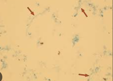 <p>Mucus</p>