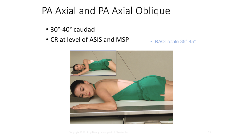 <p>14×17, (RAO) 2 from MSP to upside</p>