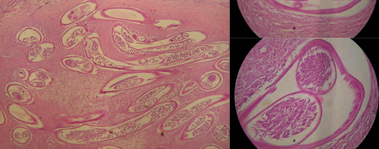 <p>What is this parasite</p>