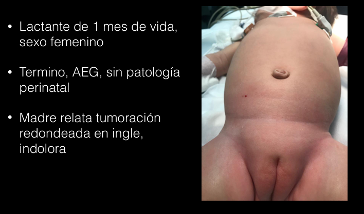 <p>Caso 3</p>