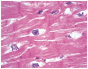 <p>contains cardiomyocyte cells</p><ul><li><p>mononucleated</p></li><li><p>striated (intercalated discs)</p></li><li><p>involuntary</p></li></ul><p>location: attached to heart wall</p>