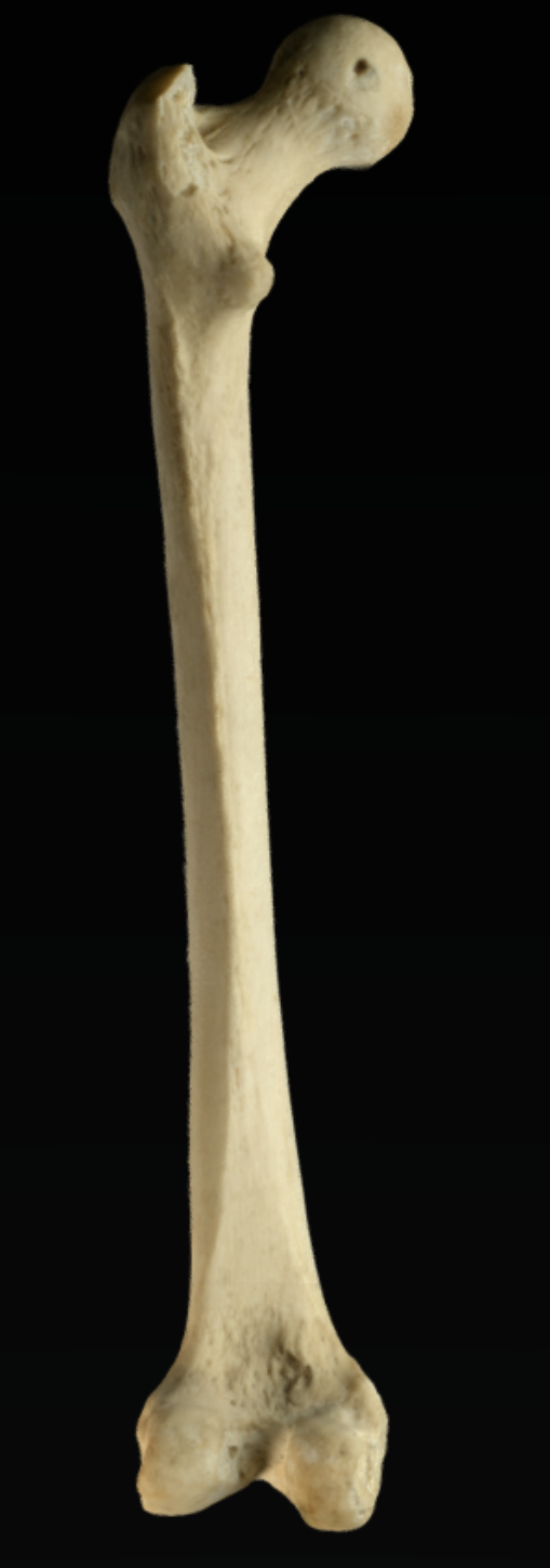 <p><strong>These bones came from the ________ side of the body.</strong></p>