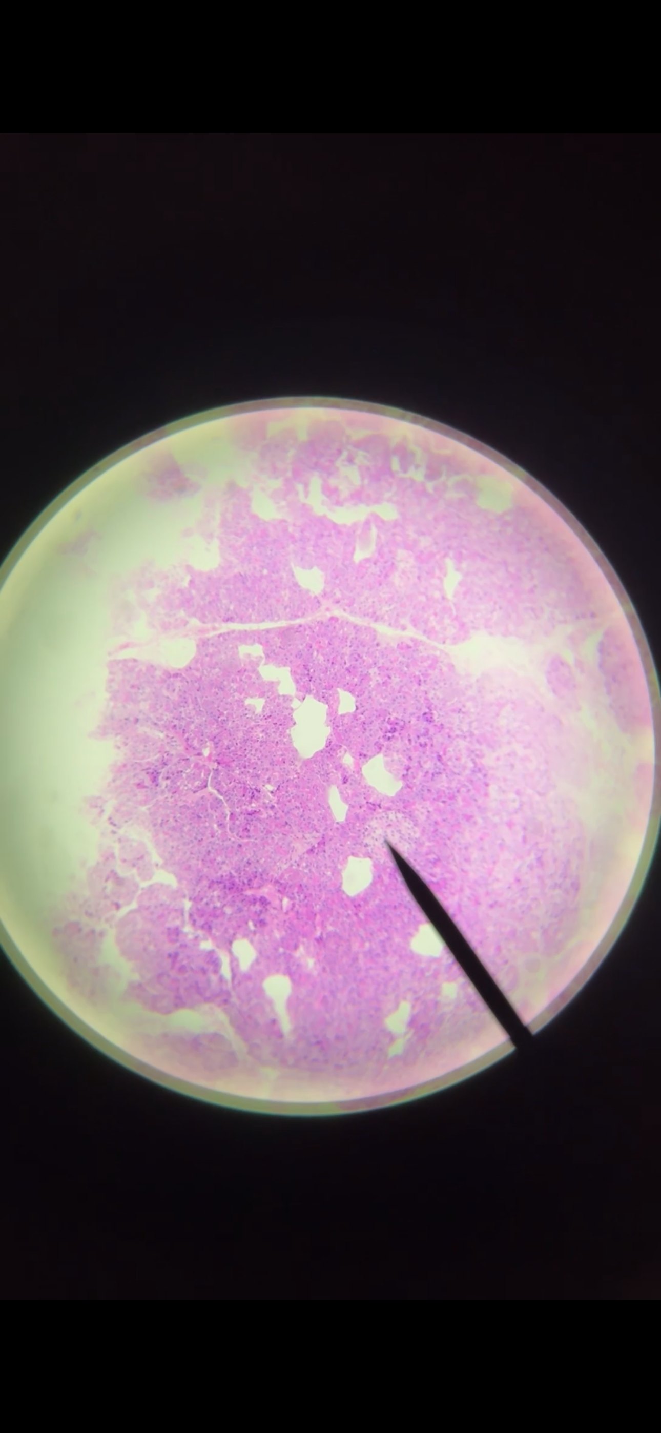 <p>What gland is this? What is the structure at the end of the pointer? What does it produce?</p>