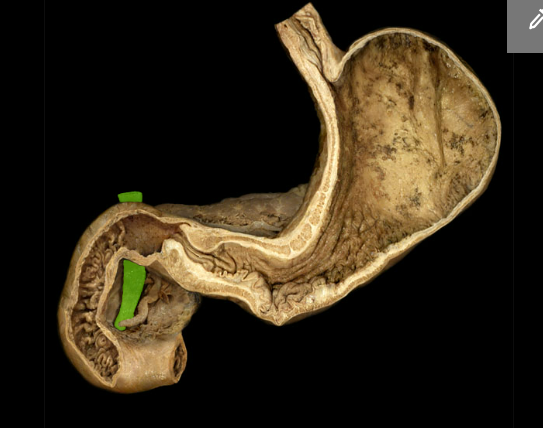 <p><span>Bile duct</span></p>