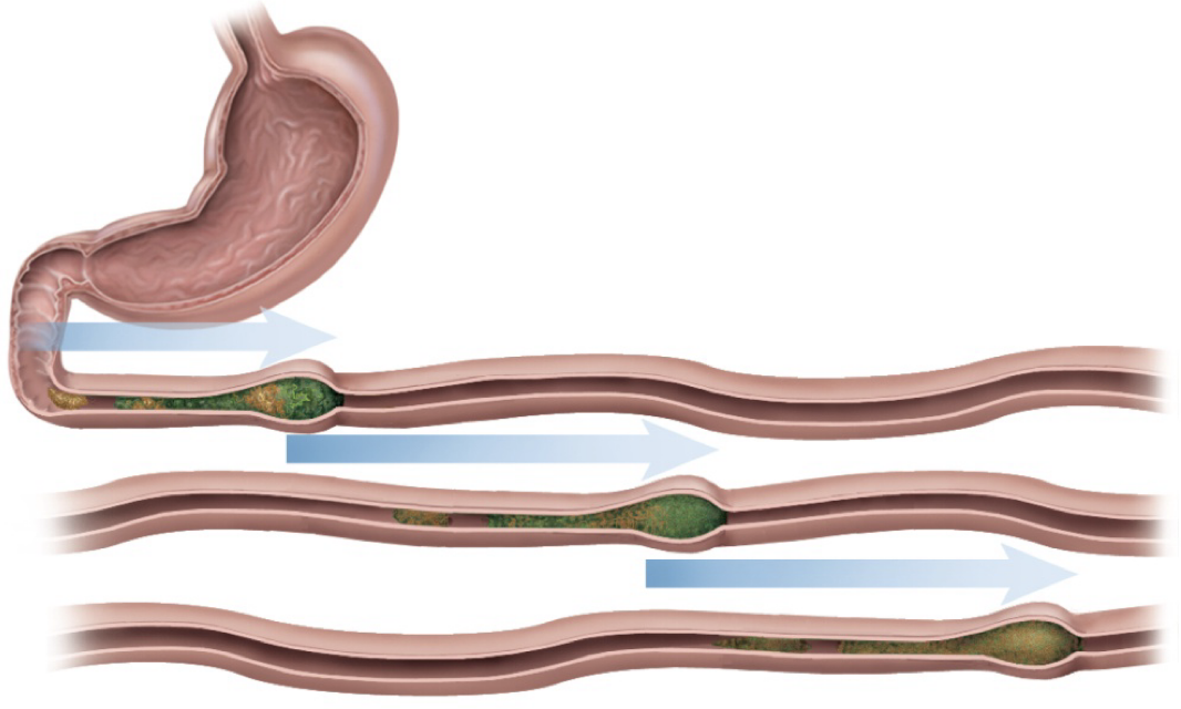 <p><strong>intestinal motility: peristalsis</strong></p><p>-____ movement of contents _____</p><p>→</p><p>→ </p><p>-refilling of ___</p>