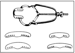 <p>which matrix band is this?</p>