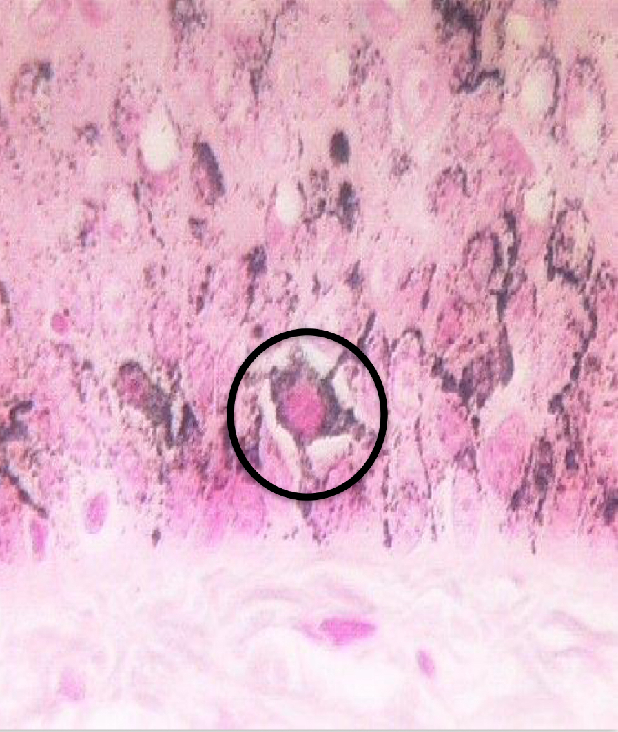<p>What cell is this? Keratinized or Non-keratinized?</p>