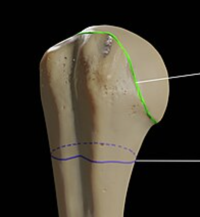 <p>whats the purple? </p>