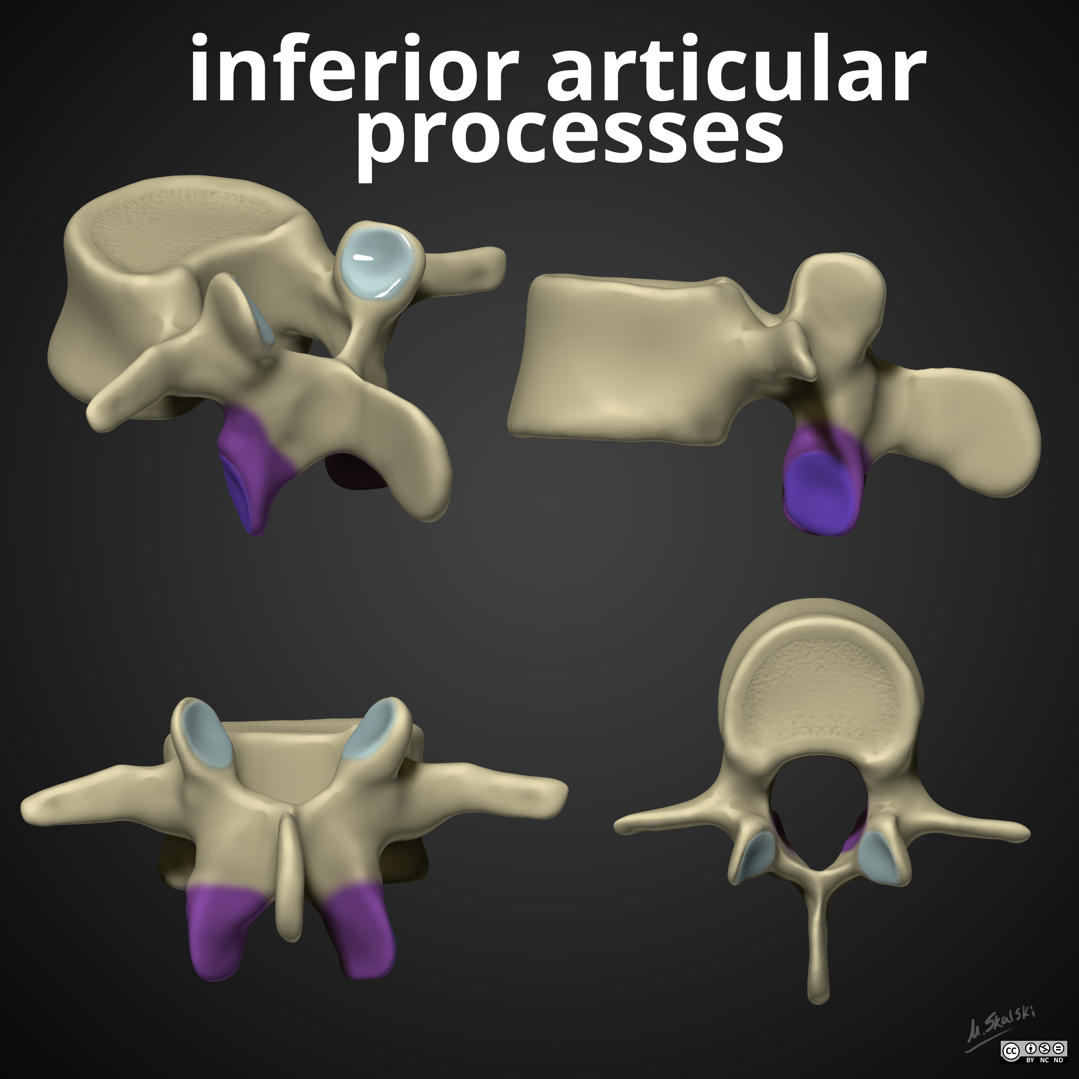 <p>Inferior articular process</p>
