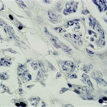 <p><em>Namazi, H., Emami, M. J., Dehghani Nazhvani, F., &amp; Dehghani Nazhvani, A. (2019). Differentiated nerve bundle showing myelinated neurons, Weil’s stain, 400× [Photomicrograph].</em></p>