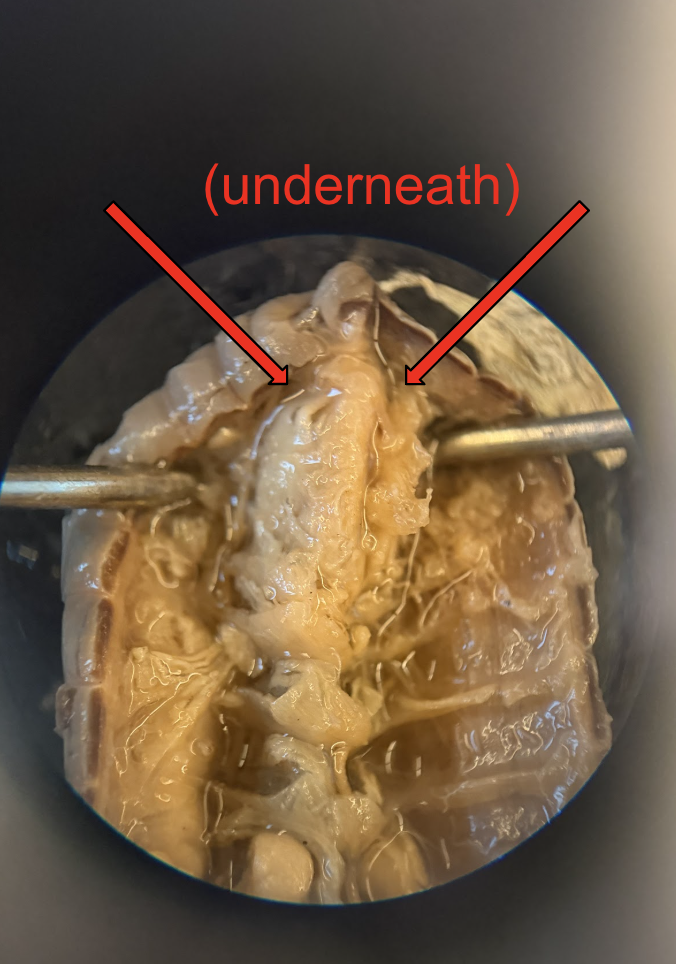 <p>What is this Structure? What is the Function?</p>