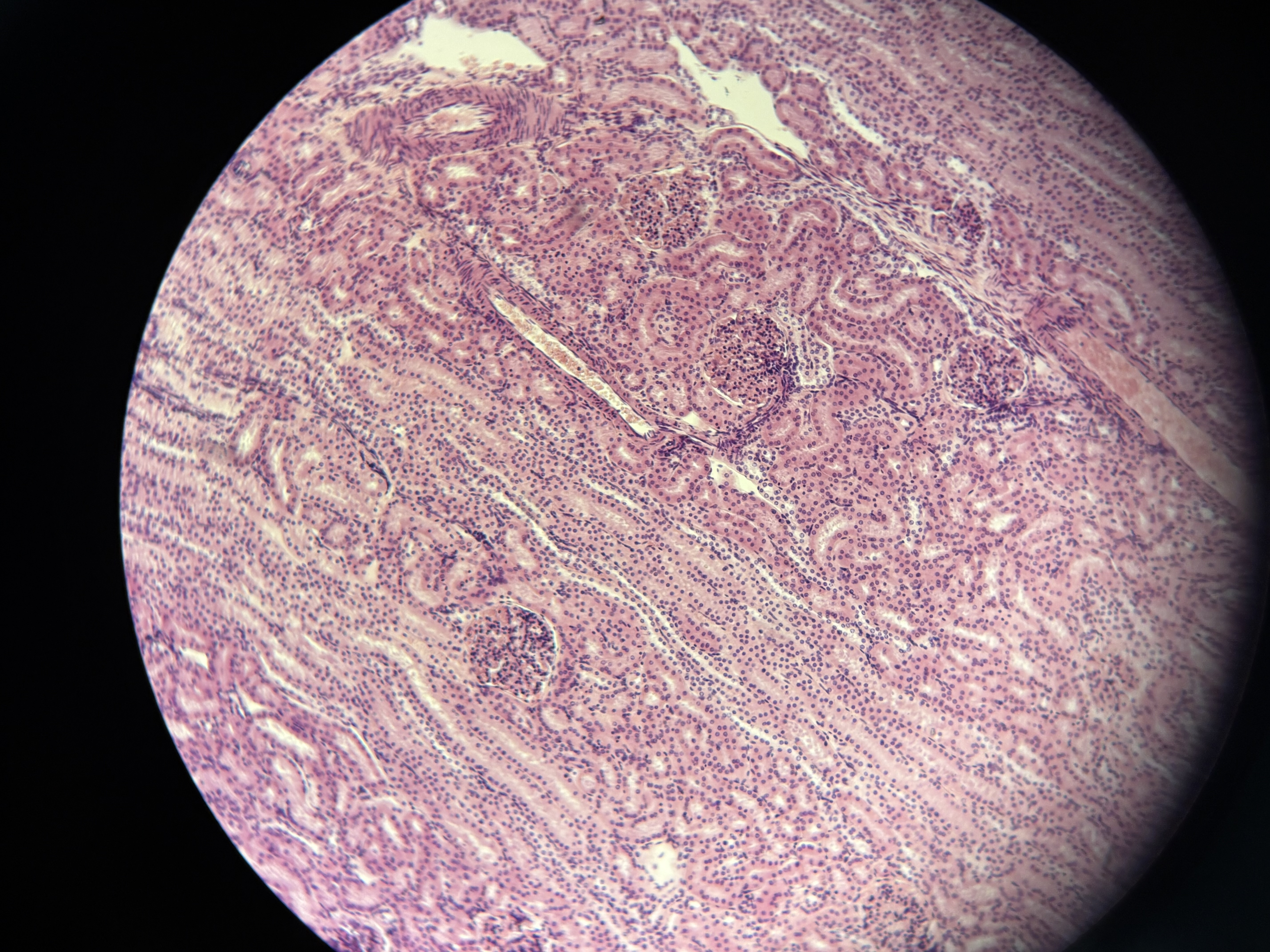 <p>What is the tissue shown as well as the epithelium?</p>