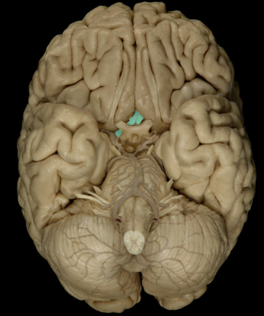 <p>Identify the artery to the brain (circle of willis)</p>