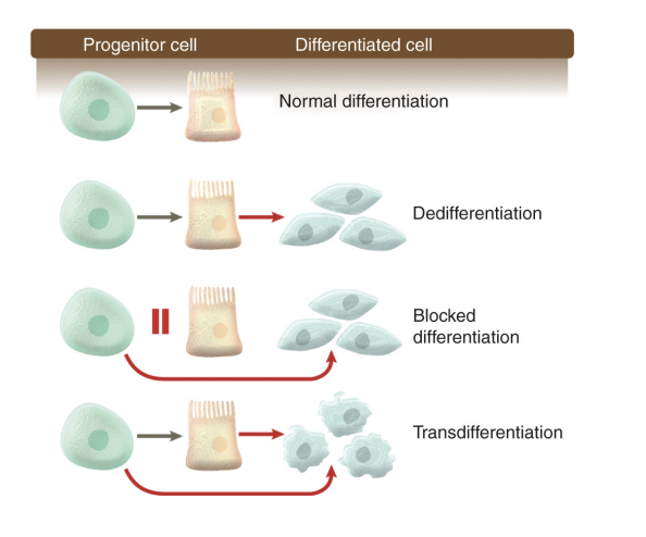 <p>unlocking the normal restricted capacity for phenotypic plasticity to evade or escape terminal differentiation</p>