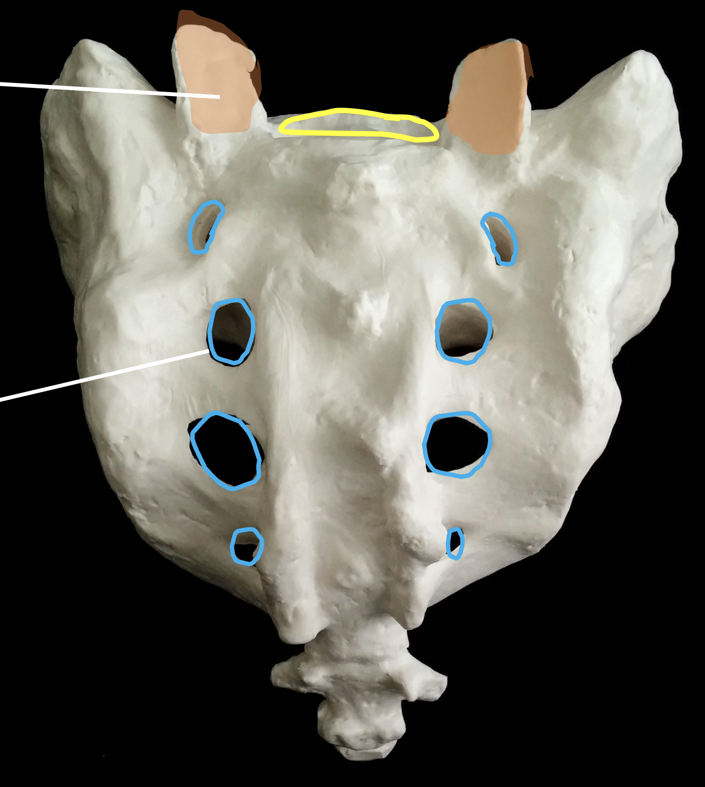 <p>What is the yellow region highlighted on the sacrum?</p>
