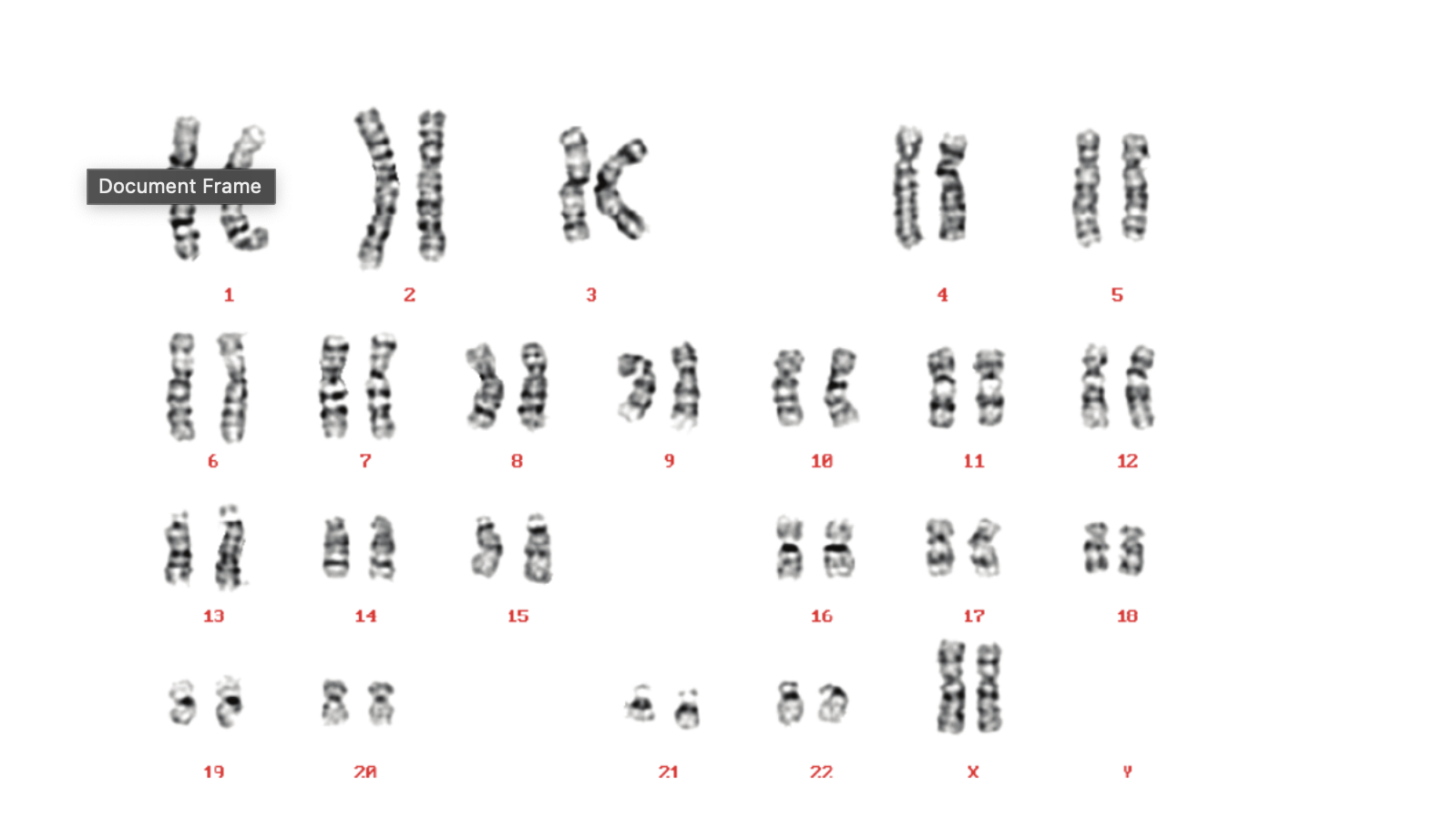 <p><span>Based on this karyotype, you know this person is...</span></p>