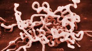<p>gram - spirillum</p>
