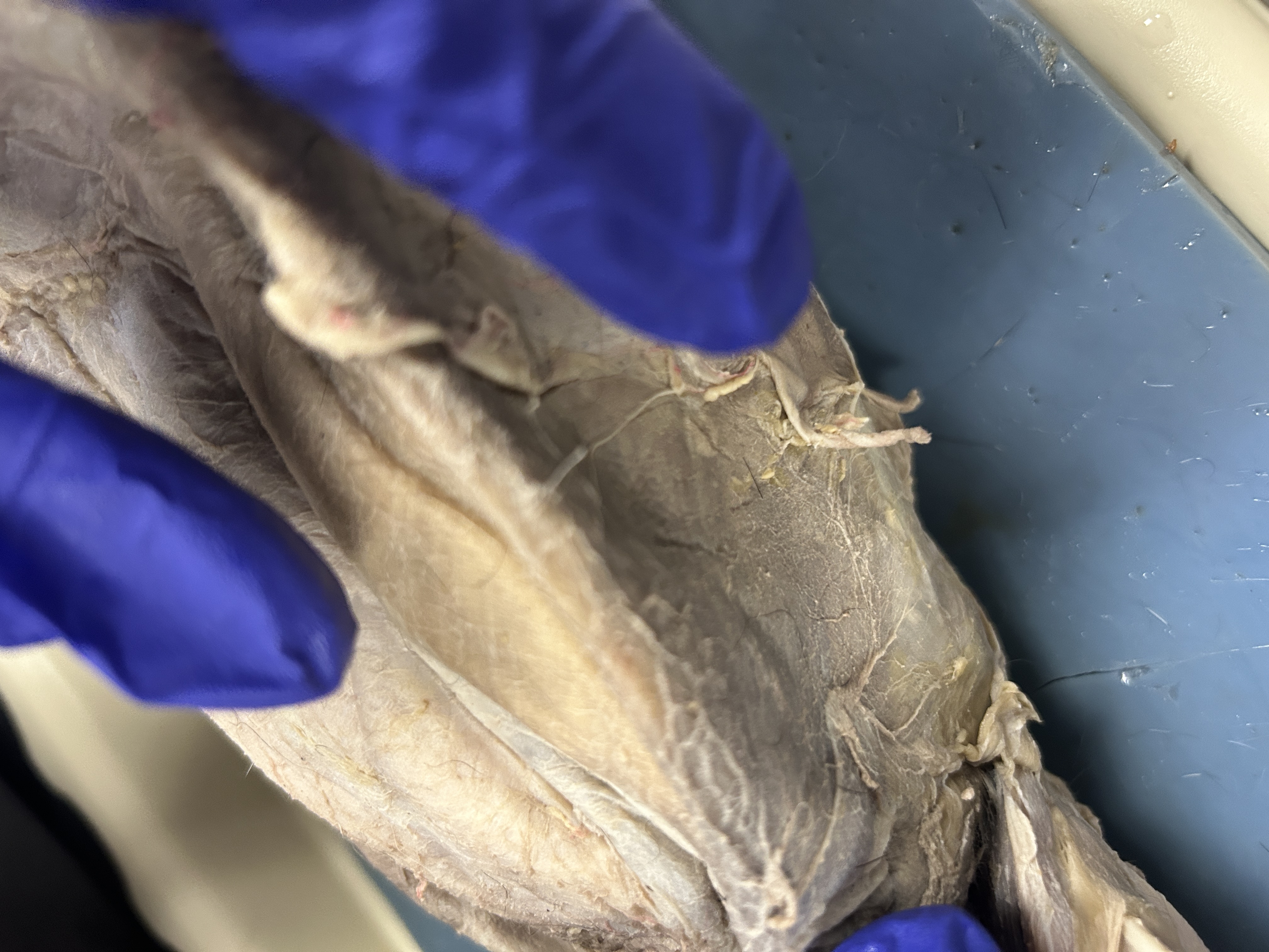 <p>external oblique (flap on side )</p>