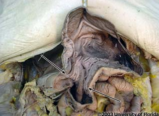 <p>what structure is pictured here?</p>