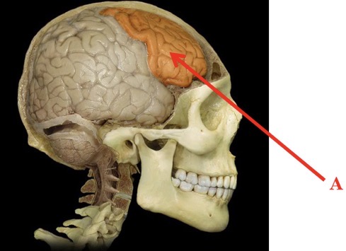 term image