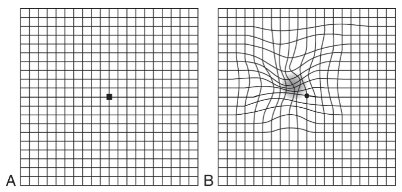 <p>Diagnostic studies for AMD</p>