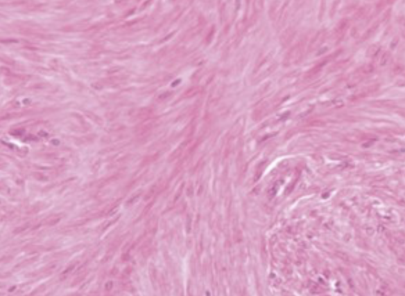 <p>classify the tissue in the field</p>