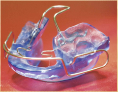 <p>A ..... has minimal palatal acrylic</p>