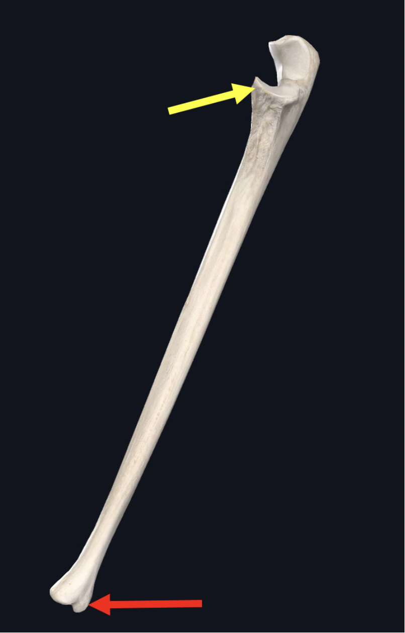 <p><span>Identify this bone</span></p>