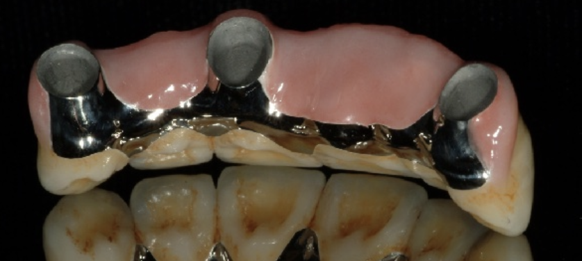 <p>What is an indication for zinc phosphate?</p>