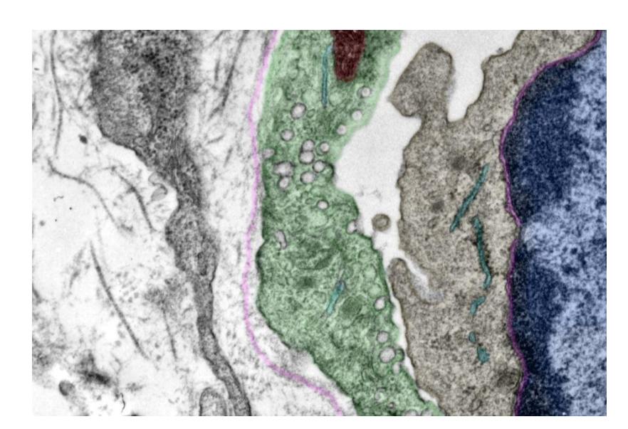 <p>Identify the white circles </p>