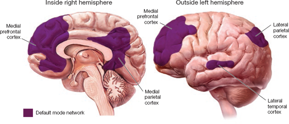 <p>DMN</p>