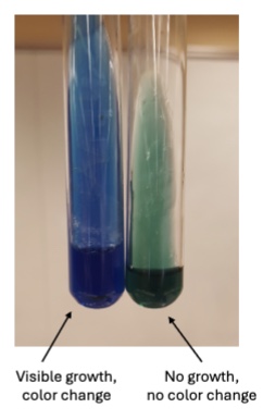 <p>The media stays that green color with no growth present  → bacterium does not use citrate as a carbon source </p>
