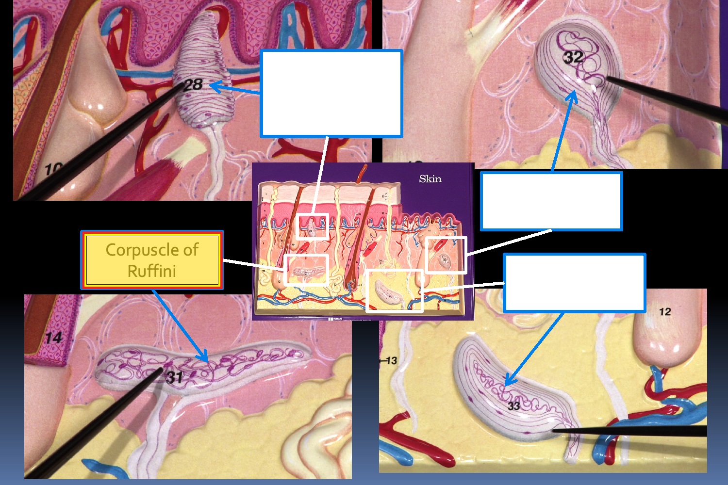 <p>Structure: Corpuscle of Ruffini</p>