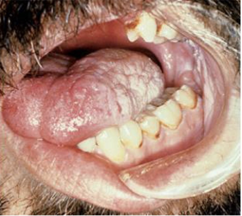 <p>BN CÓ VẾT LOÉT, CHẢY MÁU</p><p>CẢM GIÁC NÓNG BỎNG</p><p>CHẨN ĐOÁN ?</p>