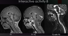 <p>Would this lead to difficulty swallowing? </p><p>a. Yes </p><p>b. No</p>