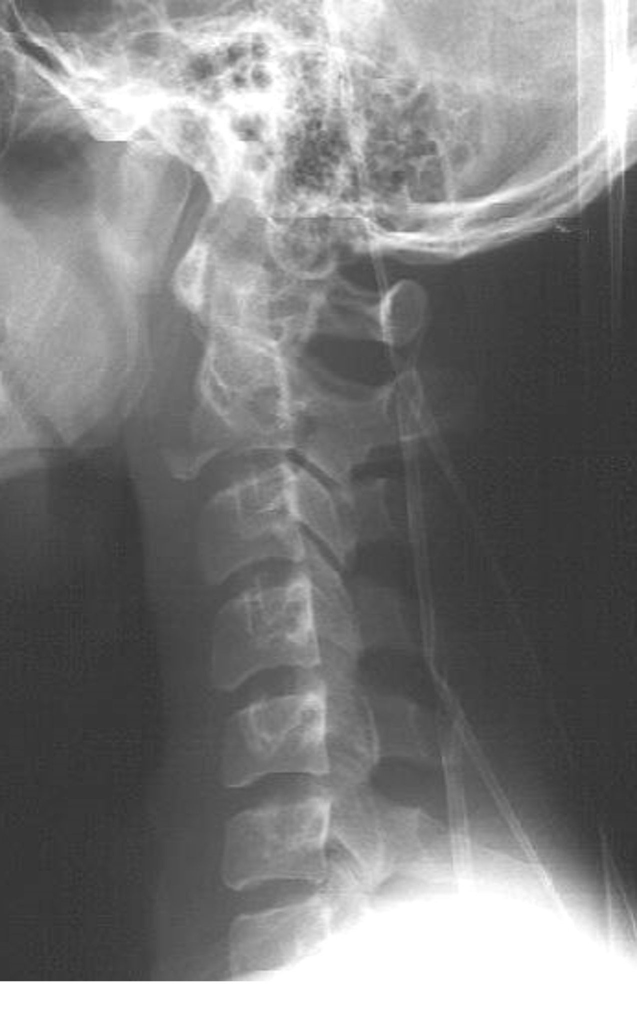 <p>What is the diagnosis?</p>