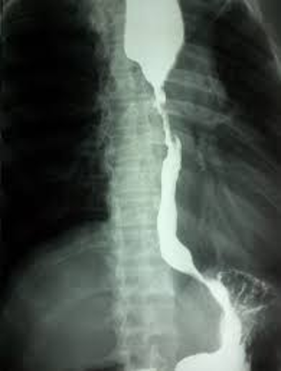 <p>Diagnosis</p>