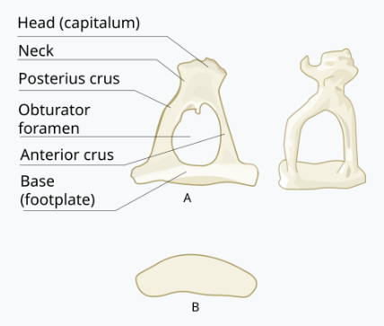 Which bone is this?