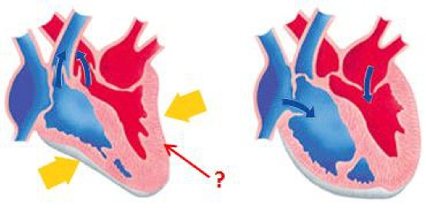 <p>The portion of the cardiac cycle in which the heart expels blood.</p>