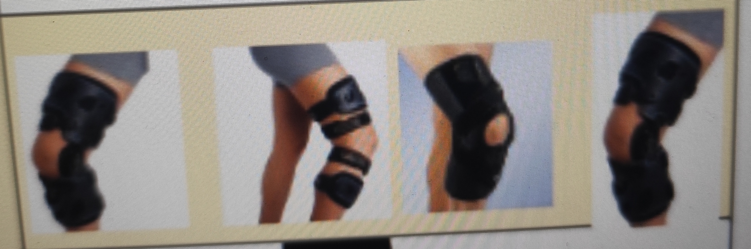 <p>ORTESIS PARA ARTROSIS DE RODILLA (TIPO RODILLERAS)</p>