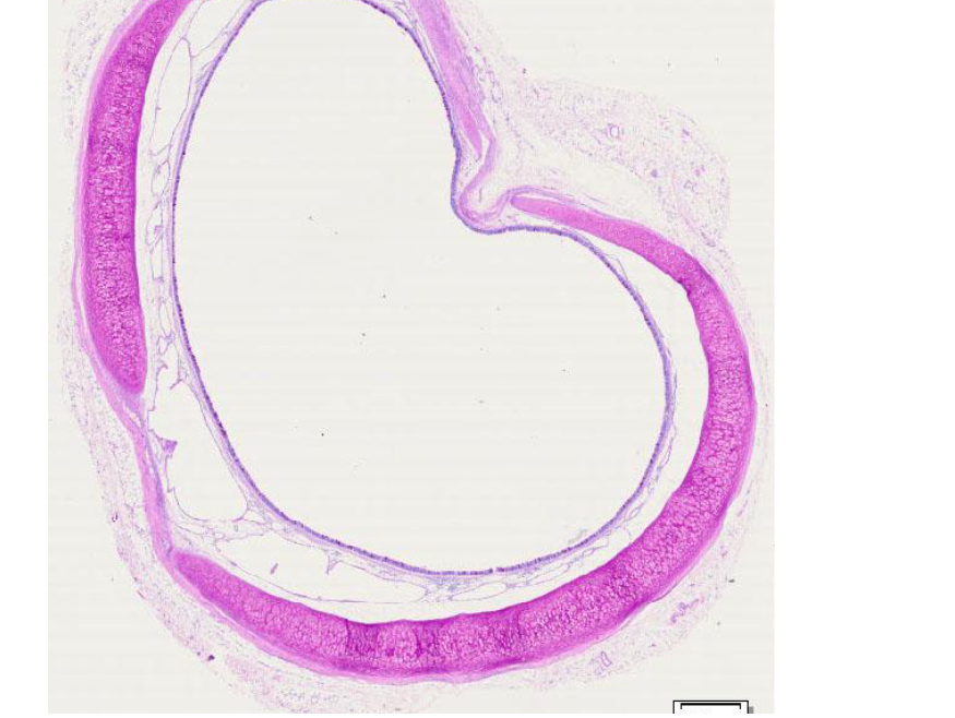 <p>wat kleurt pas positief</p>