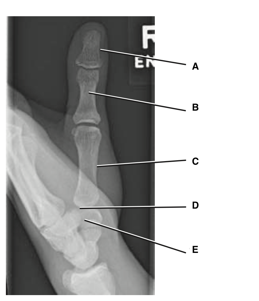 <p>A</p>