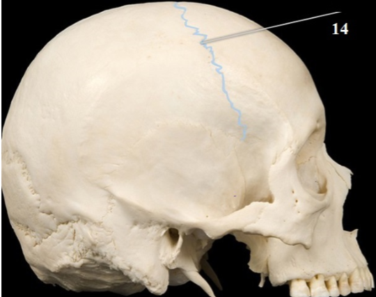 <p>Name This Suture</p>