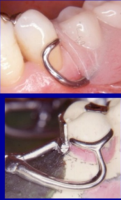 <p>identify the image on the top and image on the bottom </p>