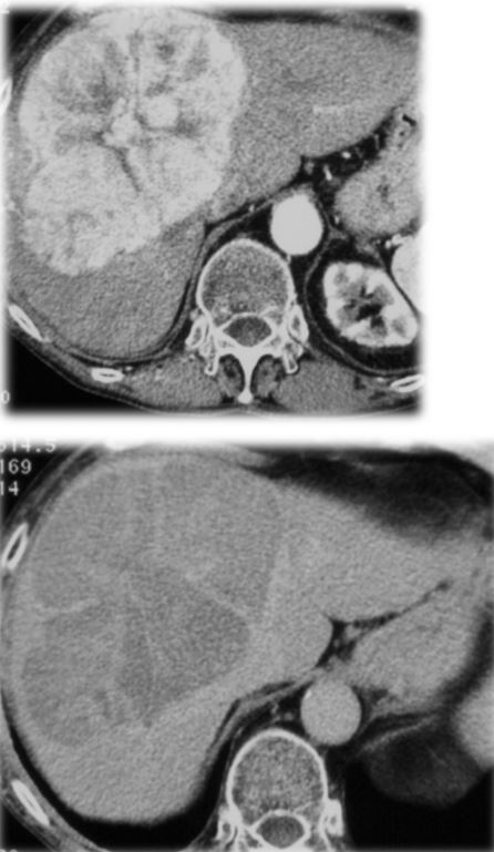 <ol><li><p>Imenuj tehniko slikanja </p></li><li><p>Naštej anatomske strukture, prikazane na sliki </p></li><li><p>Kakšna je razlika med slikama</p></li><li><p>Kateri je položaj slikanja? </p></li><li><p>Opiši patološke spremembe na sliki </p></li><li><p>Diagnoza?</p></li></ol><p></p>