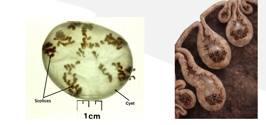 <p>What type of metacestode stage is this? </p>